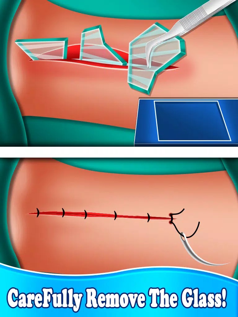 手鼻子心脏手术(Heart Surgery)
